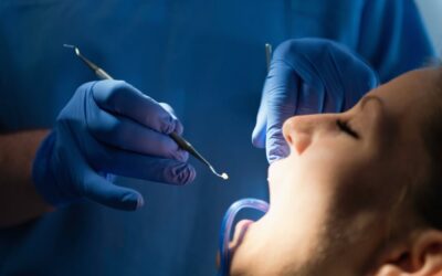 Composite Tooth-Colored Fillings