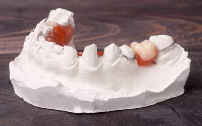 Partial Dentures