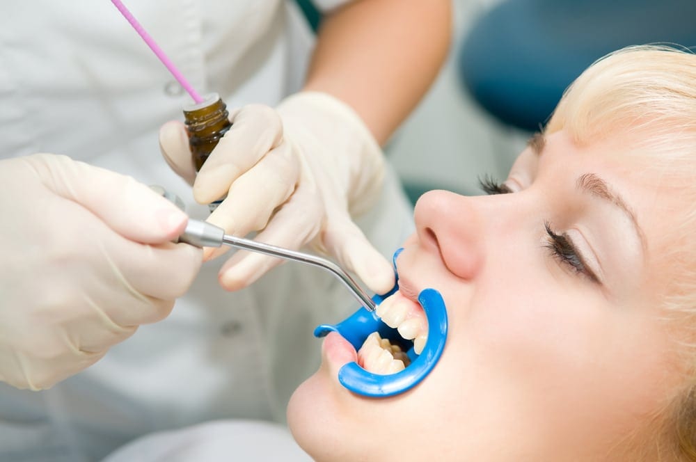 Female having Dental Sealants