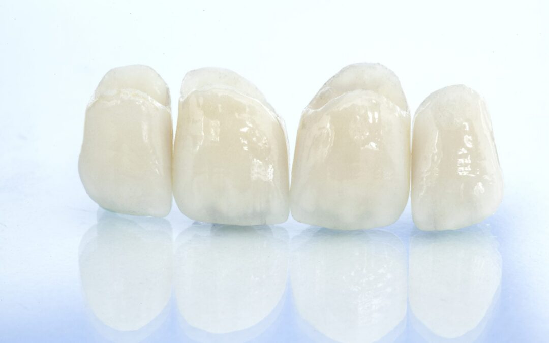 BruxZir Crown