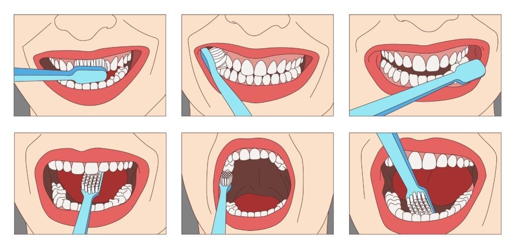 diagram on how to brush teeth
